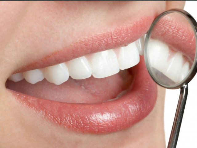 Az a fránya fogkő…