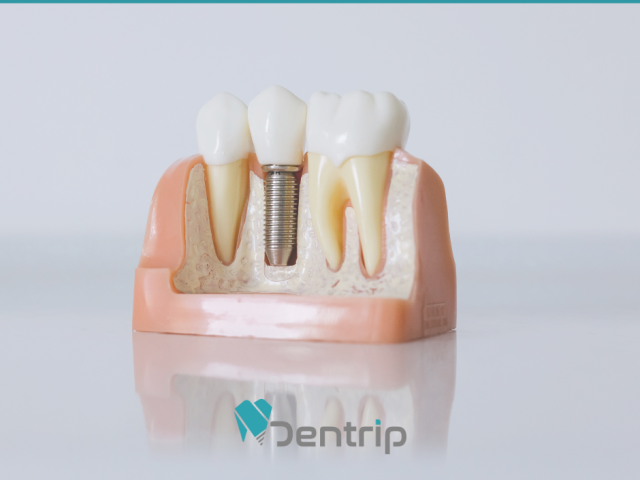 A teljes fogatlanság