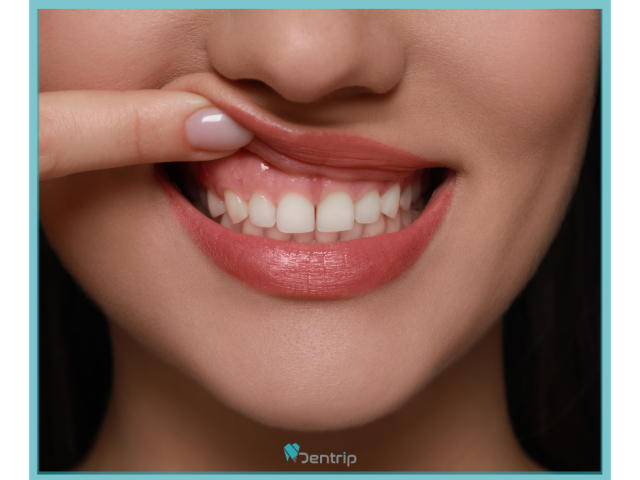 Napi rutinunk része: a fogmosás