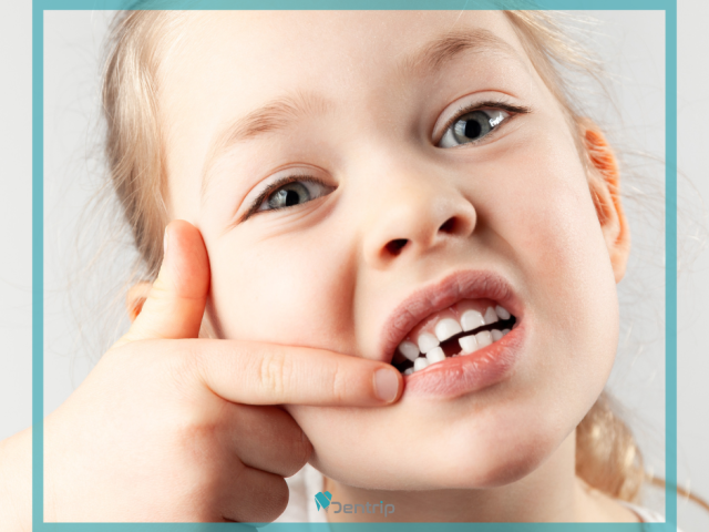Gyermekfogászat: a tejfogaktól a maradófogakig